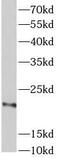 Galanin And GMAP Prepropeptide antibody, FNab10001, FineTest, Western Blot image 