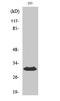 Major Histocompatibility Complex, Class II, DO Beta antibody, STJ93543, St John