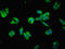Translocase Of Inner Mitochondrial Membrane 10B antibody, LS-C676592, Lifespan Biosciences, Immunofluorescence image 