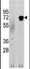 Calcium/Calmodulin Dependent Protein Kinase Kinase 2 antibody, PA5-13909, Invitrogen Antibodies, Western Blot image 