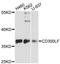 CMRF35-like molecule 1 antibody, LS-C748854, Lifespan Biosciences, Western Blot image 