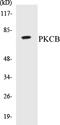 Protein Kinase C Beta antibody, EKC1468, Boster Biological Technology, Western Blot image 