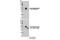 OTU Deubiquitinase With Linear Linkage Specificity antibody, 14127S, Cell Signaling Technology, Western Blot image 