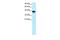 Nuclear Transcription Factor Y Subunit Alpha antibody, GTX77851, GeneTex, Western Blot image 