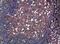 Tryptase Delta 1 antibody, A13747, Boster Biological Technology, Immunohistochemistry paraffin image 