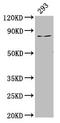 LAS1 Like, Ribosome Biogenesis Factor antibody, LS-C672445, Lifespan Biosciences, Western Blot image 