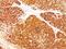 Melanoma Marker antibody, orb389058, Biorbyt, Immunohistochemistry paraffin image 
