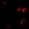Interleukin 1 Receptor Antagonist antibody, orb378130, Biorbyt, Immunocytochemistry image 