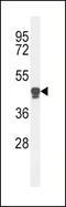 Phospholipase A2 Group VII antibody, 64-131, ProSci, Western Blot image 