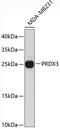 Peroxiredoxin 3 antibody, 19-383, ProSci, Western Blot image 