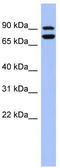 SRY-Box 6 antibody, TA345481, Origene, Western Blot image 