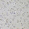 CD59 Molecule (CD59 Blood Group) antibody, LS-C331645, Lifespan Biosciences, Immunohistochemistry paraffin image 