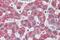 Interleukin 1 Receptor Associated Kinase 4 antibody, GTX89550, GeneTex, Immunohistochemistry paraffin image 