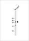 Aquaporin-11 antibody, 62-053, ProSci, Western Blot image 