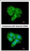 Cyclin Dependent Kinase 5 antibody, NBP2-15843, Novus Biologicals, Immunocytochemistry image 