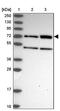 Zinc Finger Protein 467 antibody, PA5-60161, Invitrogen Antibodies, Western Blot image 