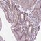 Chromobox 6 antibody, NBP2-14441, Novus Biologicals, Immunohistochemistry paraffin image 