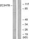 Zinc Finger CCCH-Type Containing 7B antibody, PA5-38818, Invitrogen Antibodies, Western Blot image 