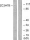 Zinc Finger CCCH-Type Containing 7B antibody, PA5-38818, Invitrogen Antibodies, Western Blot image 