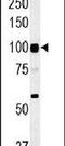 ATPase H+ Transporting V0 Subunit A4 antibody, PA5-25286, Invitrogen Antibodies, Western Blot image 