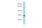 PHD Finger Protein 7 antibody, PA5-69219, Invitrogen Antibodies, Western Blot image 