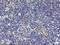 Dipeptidyl Peptidase 9 antibody, M04552-2, Boster Biological Technology, Immunohistochemistry paraffin image 