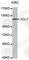 ATP Citrate Lyase antibody, A0646, ABclonal Technology, Western Blot image 