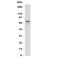Purinergic Receptor P2X 7 antibody, R31244, NSJ Bioreagents, Western Blot image 