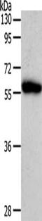 Angiotensinogen antibody, CSB-PA693559, Cusabio, Western Blot image 
