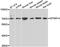 Myotubularin Related Protein 14 antibody, LS-C349175, Lifespan Biosciences, Western Blot image 