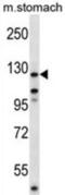 Protein Tyrosine Kinase 2 antibody, abx028067, Abbexa, Western Blot image 