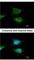 Glucosylceramidase Beta antibody, NBP1-32271, Novus Biologicals, Immunofluorescence image 