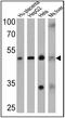 Adenosine A2a Receptor antibody, PA1-042, Invitrogen Antibodies, Western Blot image 