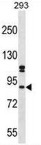SPT6 Homolog, Histone Chaperone And Transcription Elongation Factor antibody, AP54110PU-N, Origene, Western Blot image 