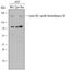 Lysine Demethylase 5B antibody, AF6477, R&D Systems, Western Blot image 