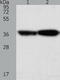 Tropomyosin 2 antibody, TA322875, Origene, Western Blot image 