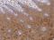Keratin 4 antibody, 200539-T10, Sino Biological, Immunohistochemistry paraffin image 