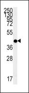 ACTH receptor antibody, PA5-25454, Invitrogen Antibodies, Western Blot image 