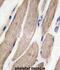 Mitogen-Activated Protein Kinase Kinase 5 antibody, abx033755, Abbexa, Immunohistochemistry frozen image 
