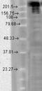 Sodium Voltage-Gated Channel Alpha Subunit 9 antibody, NBP2-12904, Novus Biologicals, Western Blot image 