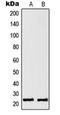 RAN, Member RAS Oncogene Family antibody, orb214494, Biorbyt, Western Blot image 