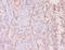 Mucin 16, Cell Surface Associated antibody, orb238405, Biorbyt, Immunohistochemistry paraffin image 
