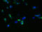 Glucagon-like peptide 1 receptor antibody, LS-C369710, Lifespan Biosciences, Immunofluorescence image 