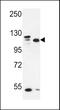 Protein transport protein Sec24C antibody, 61-657, ProSci, Western Blot image 