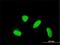 Kelch Domain Containing 4 antibody, H00054758-M02, Novus Biologicals, Immunofluorescence image 