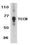 Interleukin 27 Receptor Subunit Alpha antibody, 40201, QED Bioscience, Western Blot image 