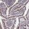 SET Domain Containing 1A, Histone Lysine Methyltransferase antibody, NBP1-81513, Novus Biologicals, Immunohistochemistry frozen image 
