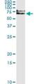 Interleukin 1 Receptor Associated Kinase 1 antibody, H00003654-M01, Novus Biologicals, Immunoprecipitation image 