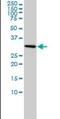 Small Nuclear Ribonucleoprotein Polypeptide A antibody, orb89686, Biorbyt, Western Blot image 