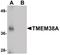 Transmembrane Protein 38A antibody, PA5-20858, Invitrogen Antibodies, Western Blot image 